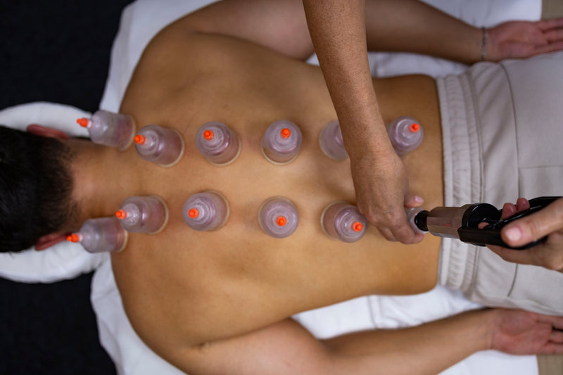 Cupping/Gua Sha