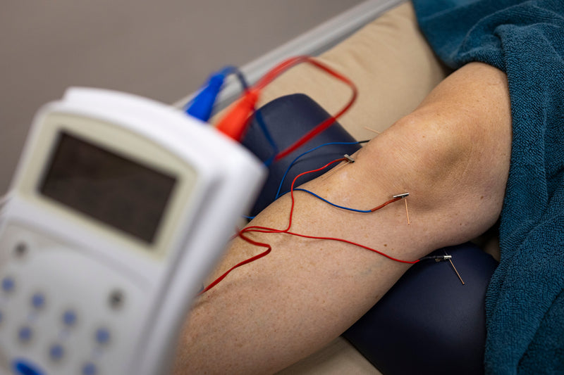 Acupuncture for Pain