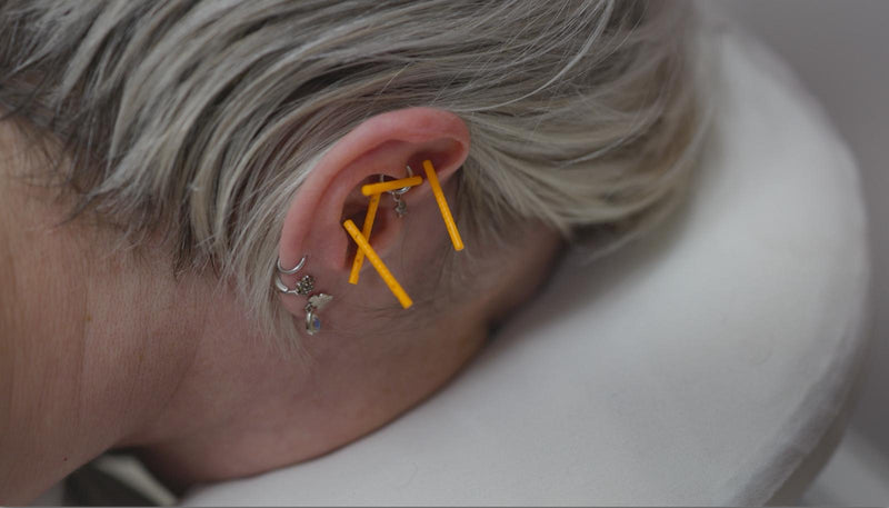 Acupuncture for Cancer Care